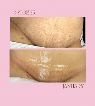 The Oxy Silk Glow System starter Kit