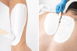 Two images showing a person with white patches on their skin, one being treated by a gloved hand.